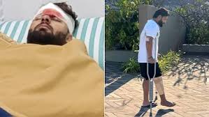Rishabh Pant’s doctor reveals his first words after horrific car accident: ‘Risk of losing a limb’