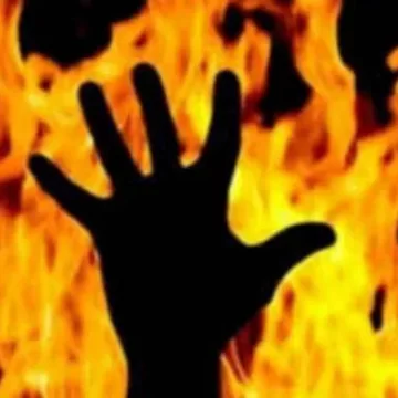 Odisha Horror: 15-Year-Old Girl Set on Fire by 3 Men While Walking to Friend’s House, Critically Injured