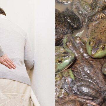 Chinese Woman Hospitalized After Swallowing Eight Live Frogs in Folk Remedy for Back Pain