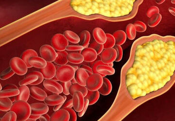 scientists-edit-gene-that-could-permanently-lower-high-cholesterol
