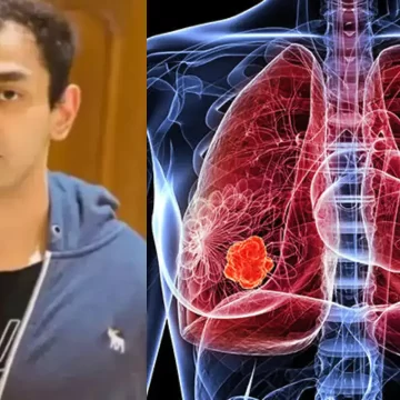 154310703 Post-Mortem Reveals Cardiorespiratory Collapse Due to Massive Blood Clot in Lungs in Prateek Yadav’s Death
