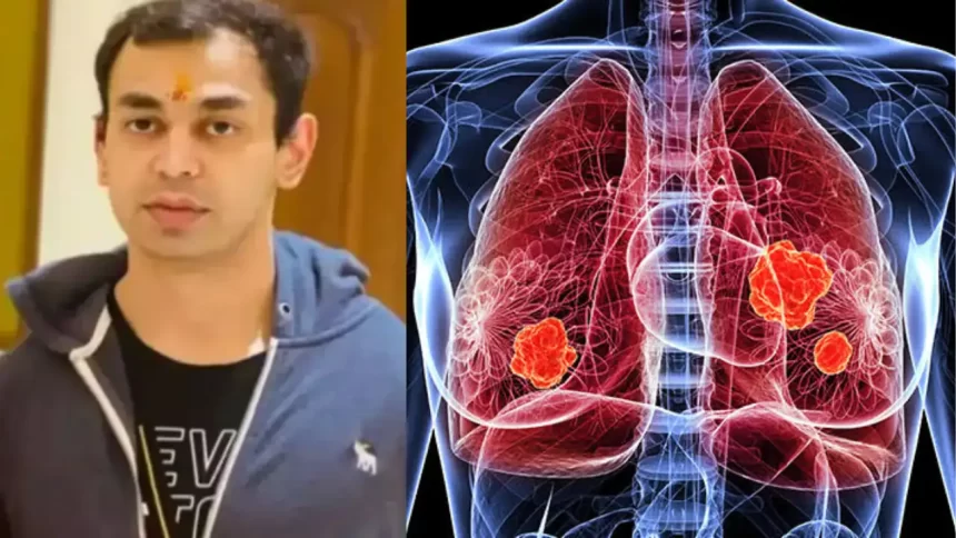 Post-Mortem Reveals Cardiorespiratory Collapse Due to Massive Blood Clot in Lungs in Prateek Yadav’s Death