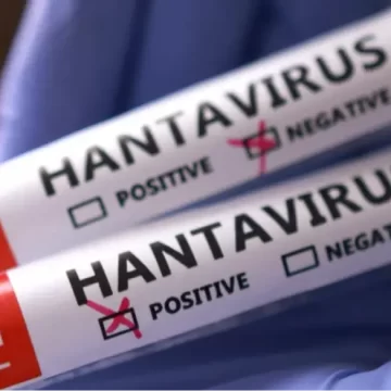 WEB_6P_HANTAVIRUS_BC_MAY_16_OM01USWR Canada Confirms First Hantavirus Case Linked to International Cruise Ship Outbreak