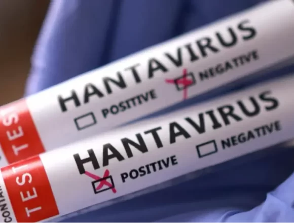 WEB_6P_HANTAVIRUS_BC_MAY_16_OM01USWR Canada Confirms First Hantavirus Case Linked to International Cruise Ship Outbreak