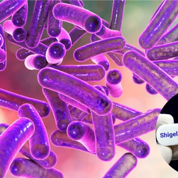 154536442 Kerala Reports Shigella Cases: Understanding the Infection, Symptoms, and Preventive Measures
