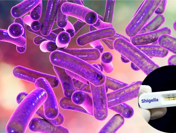 Kerala Reports Shigella Cases: Understanding the Infection, Symptoms, and Preventive Measures