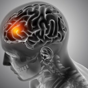 male-medical-figure-with-front-brain-highlighted_1780823141531_1780823156989_2e821a83-c681-4f7d-a7f6-05312a858efa (1) World Brain Tumour Day 2026: Seven Overlooked Warning Signs of Brain Tumours That Are Often Mistaken for Everyday Stress