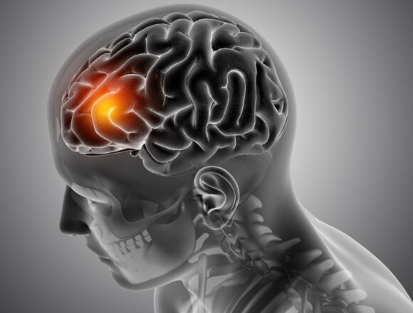 male-medical-figure-with-front-brain-highlighted_1780823141531_1780823156989_2e821a83-c681-4f7d-a7f6-05312a858efa (1) World Brain Tumour Day 2026: Seven Overlooked Warning Signs of Brain Tumours That Are Often Mistaken for Everyday Stress