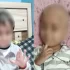 Three-Year-Old Cancer Patient Dies After Alleged Formalin Injection Error at AIIMS Bhopal; Criminal Case Filed