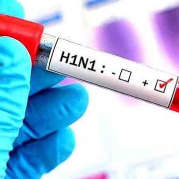 Kerala Health Department Intensifies H1N1 Surveillance in Kanhangad After Woman’s Death