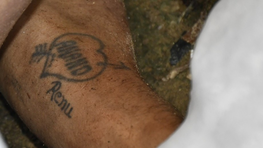 A-heart-shaped-tattoo-bearing-the-names-ANAND-and-RENU-on-the-victims-left-forearm.-Express-Photo Delhi Fare Dispute Turns Fatal as Driver, Wife and Son Arrested; Heart-Shaped Tattoo Offers Clue to Unidentified Victim